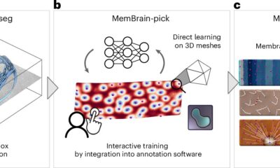 AI automates 3D membrane mapping, matching manual results in a fraction of time
