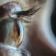 Beacon eye gene therapy hits mark in late-stage study