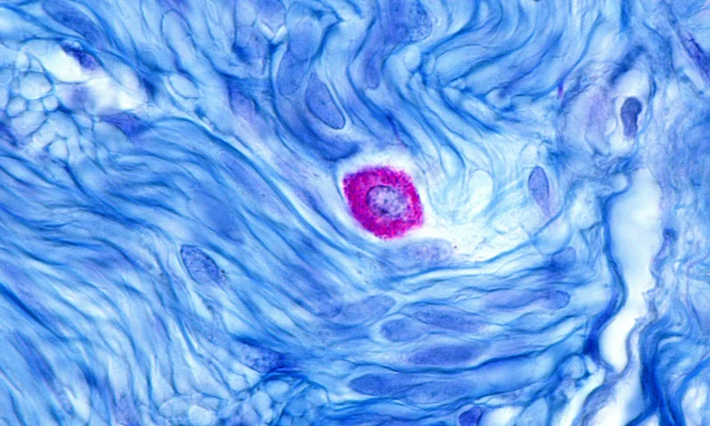 Celldex sinks as safety concerns cloud immune drug results