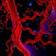 MCC protein links Wnt signaling to blood vessel polarity and remodeling