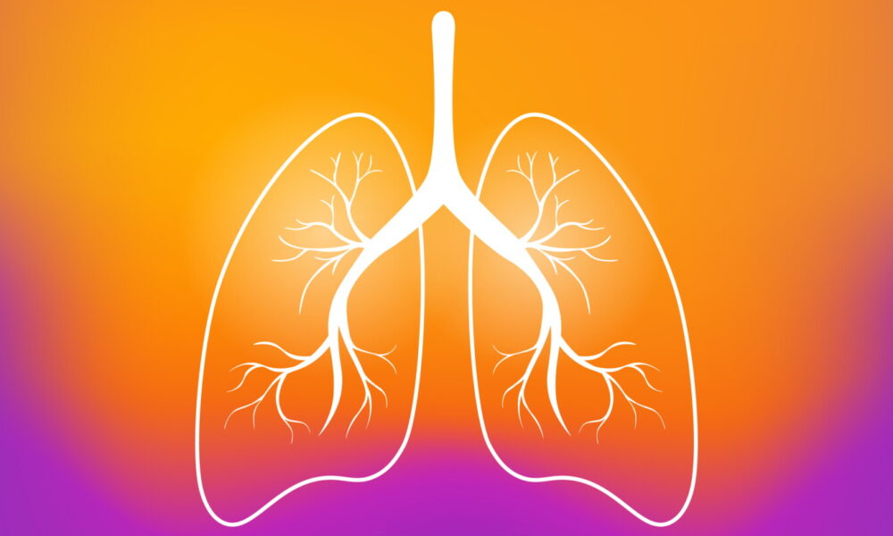 RevMed’s newly approved Rasonque could ‘hold up’ in non-small cell lung cancer