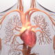 Roivant’s pulmonary hypertension drug shines with ‘blowout’ Phase 2 data
