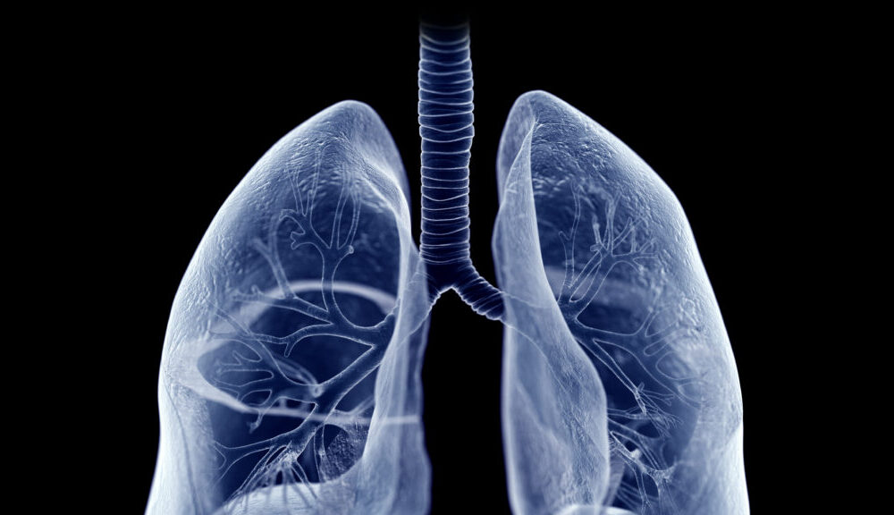 STAT+: Roivant lung disease drug hits mid-stage study goals