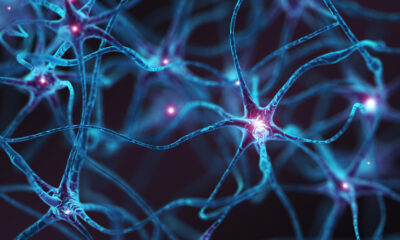 Why Does a Particular Genetic Variant Lead to Accelerated Huntington Disease Development?