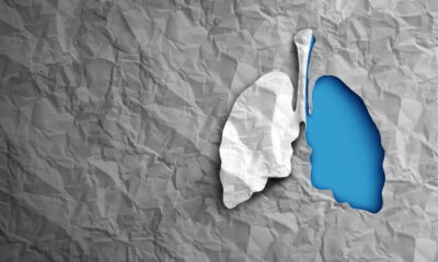 BMS’ Phase 3 win for lung drug clouded by high-dose miss