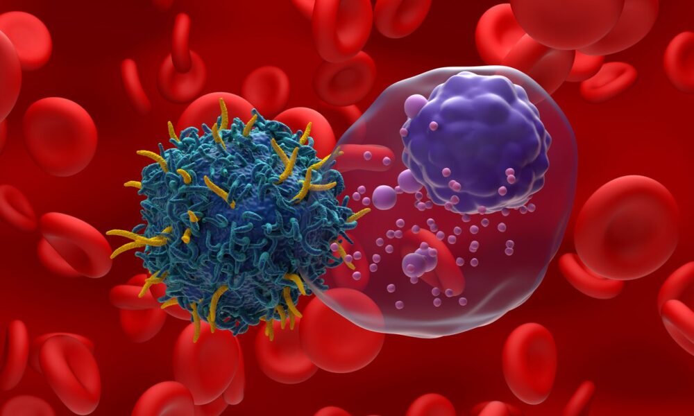Contracting Expansion: A Path to Better CAR T-Cell Therapy Production