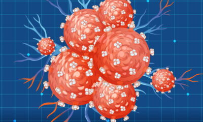 ESMO 2026: Marengo’s bispecific antibody shrinks 8 tumor types in Phase 2