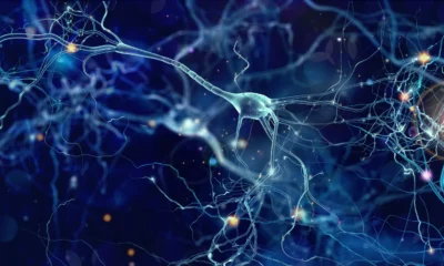 Parkinson’s cell therapy developer files to go public