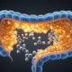 Review maps lipid metabolic links to oxaliplatin resistance in colorectal cancer