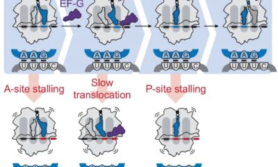 Sequence changes help modified mRNA avoid protein-making errors to improve vaccine design